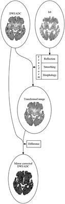 Better Diffusion Segmentation in Acute Ischemic Stroke Through Automatic Tree Learning Anomaly Segmentation